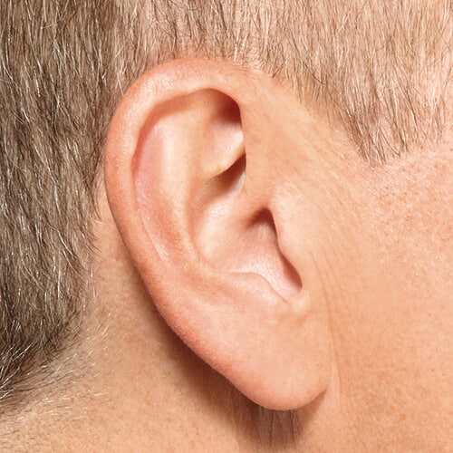 IIC hearing aids